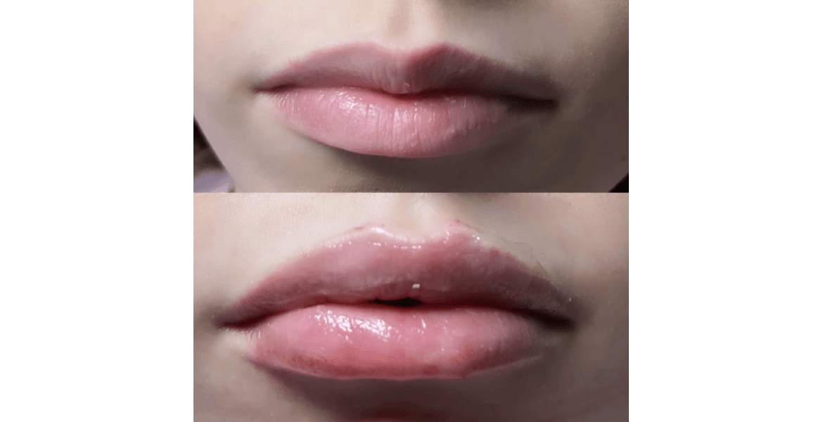 MV Aesthetics